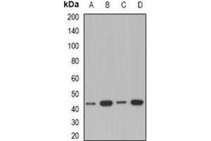 Western blot analysis of ACAA1 expression in A549 (A), Jurkat (B), mouse kidney (C), rat liver (D) whole cell lysates. (ACAA1 antibody)