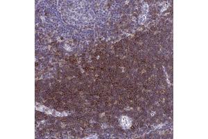 Immunohistochemical staining (Formalin-fixed paraffin-embedded sections) of human lymph node with SPN polyclonal antibody  shows strong cytoplasmic positivity in non-germinal center cells. (CD43 antibody  (AA 315-394))
