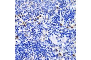 Immunohistochemistry of paraffin-embedded mouse spleen using ANXA1 antibody. (Annexin a1 antibody  (AA 1-346))