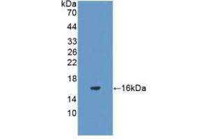 Western blot analysis of recombinant Rat FSHb. (FSHB antibody  (AA 21-130))