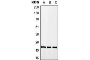 Western blot analysis of CALY expression in A549 (A), Raw264. (CALY antibody  (Center))