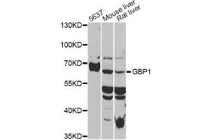 Western blot analysis of extracts of various cell lines, using GBP1 antibody (ABIN6293142) at 1:1000 dilution. (GBP1 antibody)