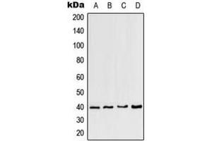 Western blot analysis of CCRL2 expression in HeLa (A), mouse heart (B), mouse brain (C), rat brain (D) whole cell lysates.