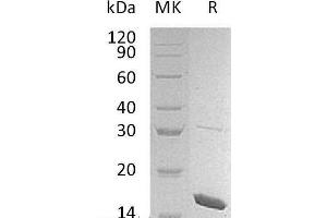 Western Blotting (WB) image for Interleukin 1 eta (FIL1h) protein (ABIN7320596) (FIL1h Protein)