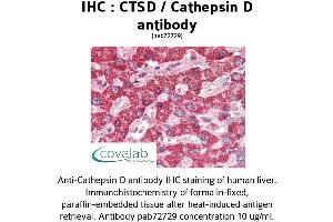 Image no. 1 for anti-Cathepsin D (CTSD) antibody (ABIN2851939) (Cathepsin D antibody)
