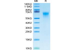 Cynomolgus CD46 on Tris-Bis PAGE under reduced condition. (CD46 Protein (CD46) (AA 35-329) (His tag))