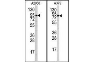 Western blot analysis of anti-Autophagy ATG9A Antibody (C-term) in A2058 and A375 cell line lysates (35ug/lane). (ATG9A antibody  (C-Term))