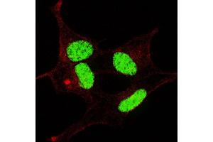 Fluorescent confocal image of SY5Y cells stained with phospho- LIN28-  antibody. (LIN28A antibody  (pSer134))