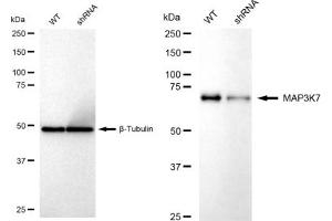 Western blotting analysis using MAP3K7 antibody (ABIN7799473).