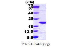 SDS-PAGE (SDS) image for Ubiquitin-Conjugating Enzyme E2B (UBE2B) (AA 1-152) protein (His tag) (ABIN667135)