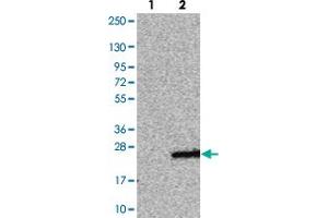 Western blot analysis of Lane 1: Negative control (vector only transfected HEK293T lysate). (CABP5 antibody)