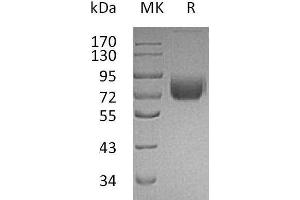 Western Blotting (WB) image for Interferon gamma Receptor 1 (IFNGR1) protein (Fc Tag) (ABIN7320564) (IFNGR1 Protein (Fc Tag))