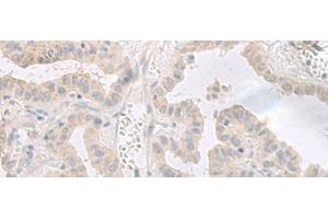 GPRASP2 antibody