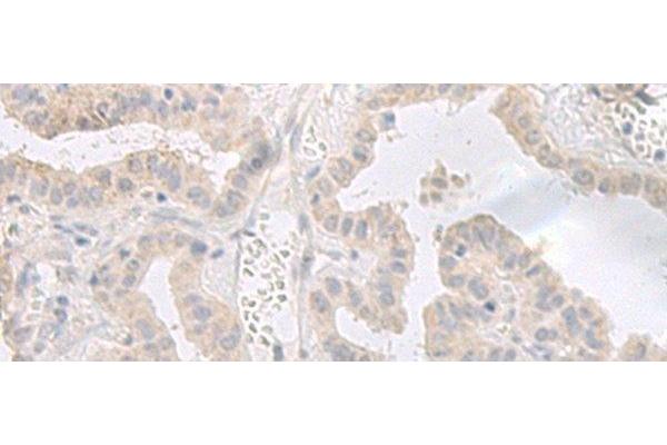 GPRASP2 antibody