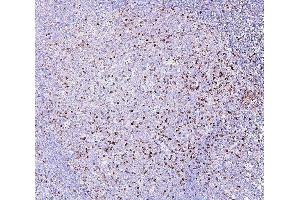 IHC analysis of RAB27A using anti-RAB27A antibody (ABIN7602714). (RAB27A antibody  (AA 98-216))