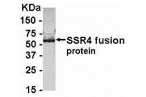 Western Blotting (WB) image for anti-Signal Sequence Receptor, delta (SSR4) (AA 61-130) antibody (ABIN2468174) (SSR4 antibody  (AA 61-130))