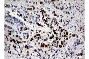 Image no. 3 for anti-Antigen Identified By Monoclonal Antibody Ki-67 (MKI67) (AA 1160-1493) antibody (ABIN1490857) (Ki-67 antibody  (AA 1160-1493))