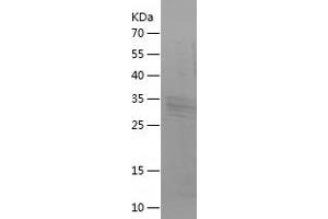BNP Protein (AA 27-121) (His-IF2DI Tag)