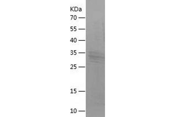 BNP Protein (AA 27-121) (His-IF2DI Tag)