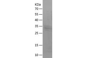 Western Blotting (WB) image for Brain Natriuretic Peptide (BNP) (AA 27-121) protein (His-IF2DI Tag) (ABIN7283853) (BNP Protein (AA 27-121) (His-IF2DI Tag))