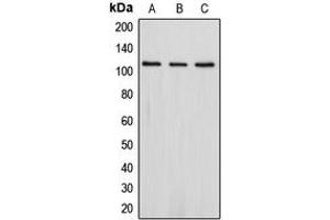 Western blot analysis of PSD93 expression in Jurkat (A), SHSY5Y (B), HepG2 (C) whole cell lysates. (DLG2 antibody  (Center))