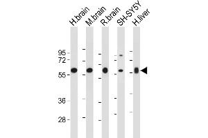 All lanes : Anti-INA Antibody (Center) at 1:2000 dilution Lane 1: Human brain tissue lysate Lane 2: Mouse brain tissue lysate Lane 3: Rat brain tissue lysate Lane 4: SH-SY5Y whole cell lysate Lane 5: Human liver tissue lysate Lysates/proteins at 20 μg per lane. (INA antibody  (AA 290-319))