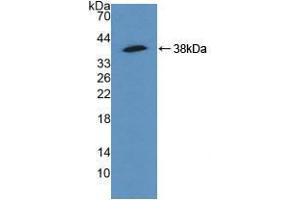 Figure. (alpha Actinin 4 antibody  (AA 1-269))