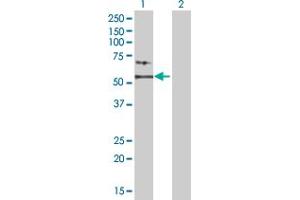 Lane 1: KRT14 transfected lysate ( 51. (KRT14 293T Cell Transient Overexpression Lysate(Denatured))