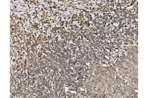 IHC analysis of KIF2A using anti-KIF2A antibody (ABIN7600510). (KIF2A antibody  (AA 2-706))