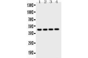Observed bind size: 45KD (Cathepsin D antibody  (AA 65-410))