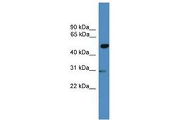 GAL3ST3 anticorps  (AA 201-250)