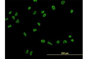 Immunofluorescence of monoclonal antibody to USF2 on HeLa cell. (USF2 antibody  (AA 1-100))