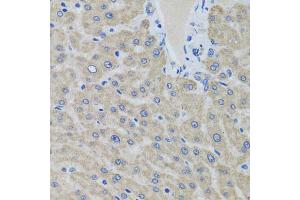 Immunohistochemistry of paraffin-embedded human liver using EIF2S3 antibody (ABIN5975415) at dilution of 1/100 (40x lens). (EIF2S3 antibody)