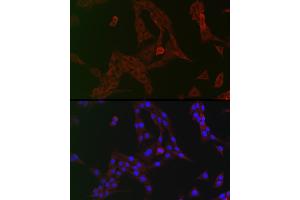 Immunofluorescence analysis of PC-12 cells using GCN2 Rabbit pAb (ABIN6127830, ABIN6140032, ABIN6140034 and ABIN6222976) at dilution of 1:150 (40x lens). (GCN2 antibody  (AA 1-300))