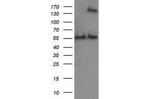 HEK293T cells were transfected with the pCMV6-ENTRY control (Left lane) or pCMV6-ENTRY CAT (Right lane) cDNA for 48 hrs and lysed. (Catalase antibody)