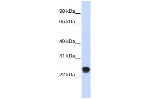 Western Blotting (WB) image for anti-FK506 Binding Protein 11, 19 KDa (FKBP11) antibody (ABIN2459089) (FKBP11 antibody)