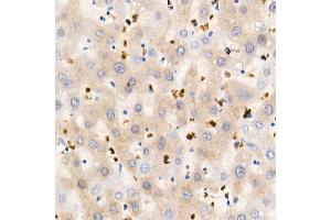 Immunohistochemistry of paraffin-embedded Human liver using IGF1 antibody (ABIN1682184, ABIN3015345, ABIN3015346 and ABIN7101347) at dilution of 1:100 (40x lens). (IGF1 antibody)