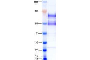 Validation with Western Blot (TLR5 Protein (Myc-DYKDDDDK Tag))