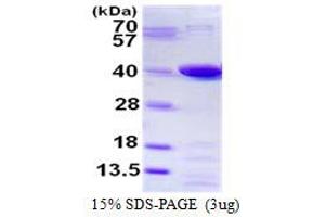 Prostaglandin Reductase 1 (PTGR1) protein (His tag)
