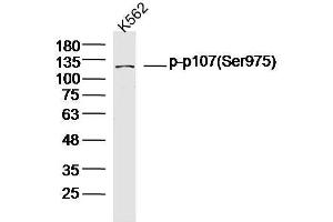 Human K562 cells probed with p107(Ser975) Polyclonal Antibody, unconjugated  at 1:300 overnight at 4°C followed by a conjugated secondary antibody at 1:10000 for 90 minutes at 37°C. (p107 antibody  (pSer975))