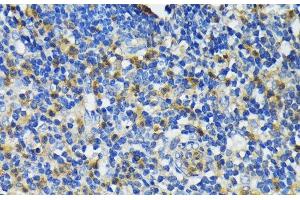 Immunohistochemistry of paraffin-embedded Human appendix using CAMP Polyclonal Antibody at dilution of 1:200 (40x lens). (Cathelicidin antibody)