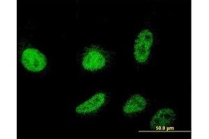 Image no. 2 for anti-Cold Shock Domain Containing C2, RNA Binding (CSDC2) (AA 1-154) antibody (ABIN466198) (CSDC2 antibody  (AA 1-154))