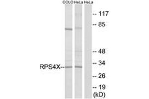 Western blot analysis of extracts from HeLa/COLO cells, using RPS4X Antibody. (RPS4X antibody  (AA 81-130))