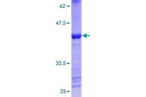 LMX1A Protein (AA 1-100) (GST tag)