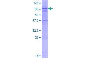 IPPK Protein (AA 1-491) (GST tag)