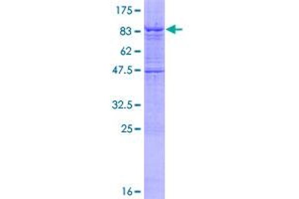 IPPK Protein (AA 1-491) (GST tag)