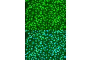 Immunofluorescence analysis of U2OS cells using BDNF antibody (ABIN1871274) at dilution of 1:100. (BDNF antibody)