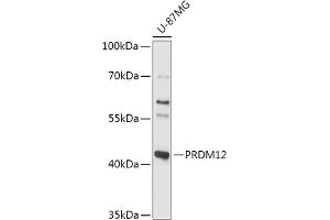 Western blot analysis of extracts of U-87MG cells, using PRDM12 antibody (ABIN7269498) at 1:1000 dilution. (PRDM12 antibody  (AA 100-330))