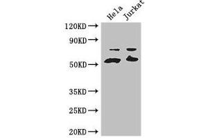 Western Blot Positive WB detected in: Hela whole cell lysate, Jurkat whole cell lysate All lanes: YES1 antibody at 3.