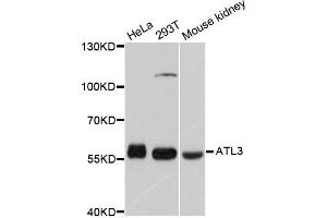 Western blot analysis of extracts of various cell lines, using ATL3 antibody (ABIN5997276) at 1/1000 dilution.